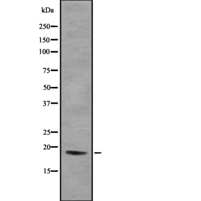 Polyclonal Rabbit anti-Human H3F3B Antibody (IHC, WB)