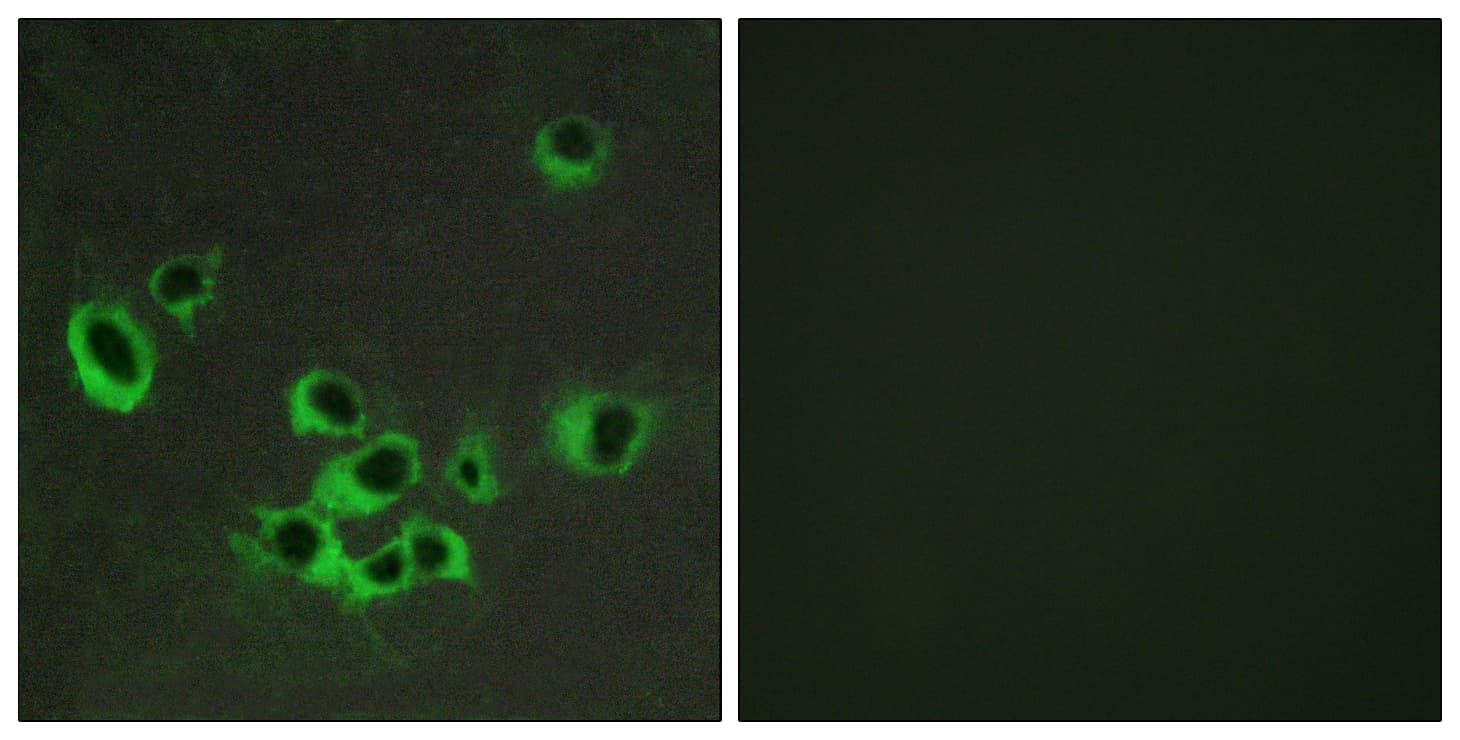 IHC-plus™ HTR2B / 5-HT2B Receptor Antibody (aa15-64)