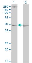 Monoclonal Mouse anti-Human PDK3 Antibody (clone 2B11, WB)