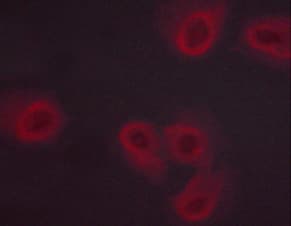 NOS3 / eNOS Antibody (phospho-Ser1177)