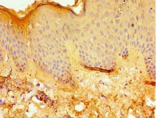 ERCC2 / XPD Antibody (aa1-300)