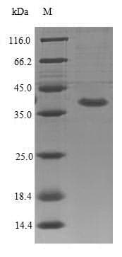 Mouse IL1RL2 Protein (Recombinant 6His, N-terminus)