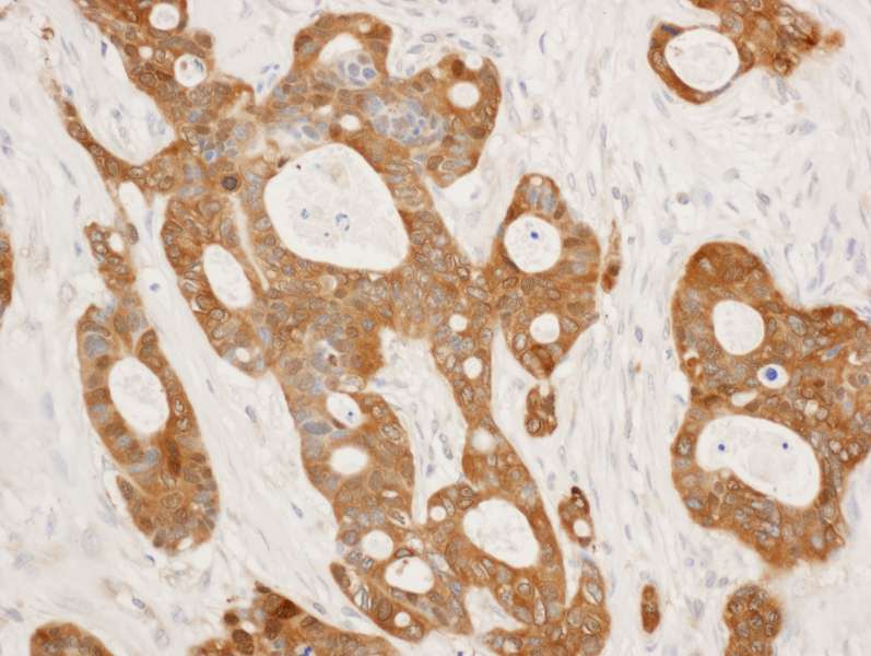 SFN / Stratifin / 14-3-3 Sigma Antibody (aa198-248)
