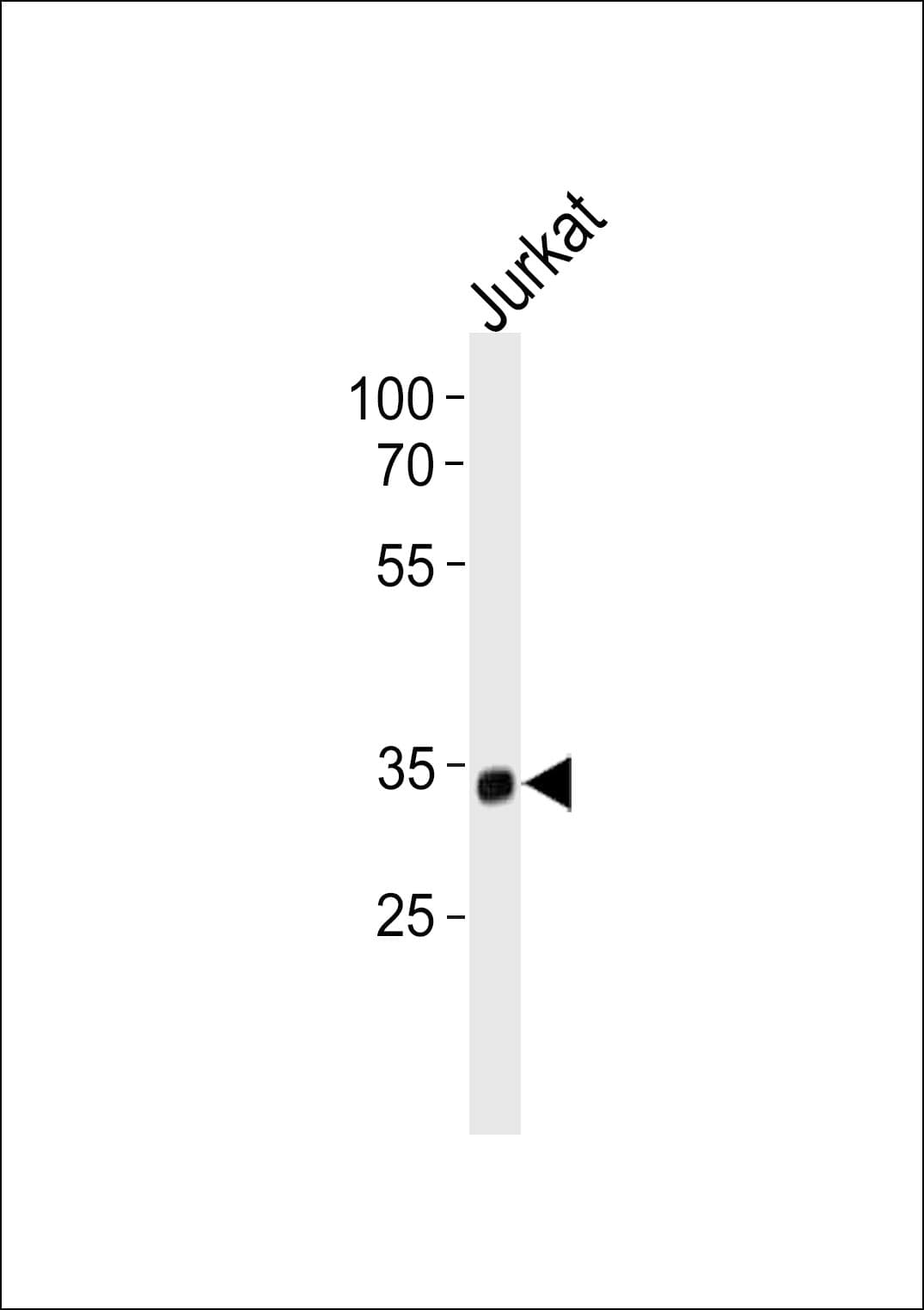 Polyclonal Rabbit anti-Human SNAP45 / SNAPC2 Antibody (aa278-307, WB)