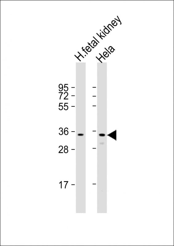 UP / UPP1 Antibody (C-Terminus)