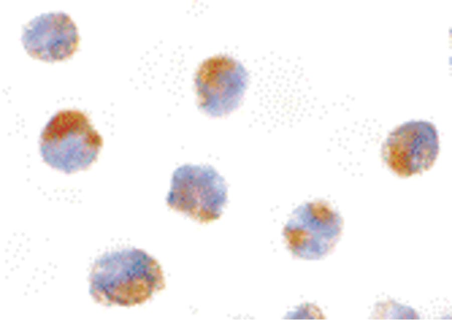 Polyclonal Rabbit anti-Human MCL1 / MCL 1 Antibody (WB)