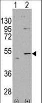 IHC-plus™ ALDH5A1 Antibody (aa128-157)
