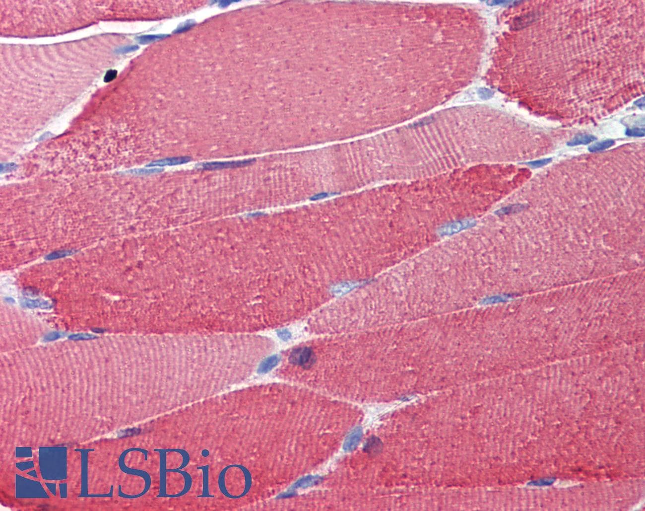 IHC-plus™ Monoclonal Mouse anti-Human MYL2 Antibody (clone AT3B2, IHC, WB)