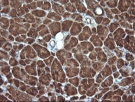MLANA / Melan-A Antibody (clone OTI5F12, Carrier-free)