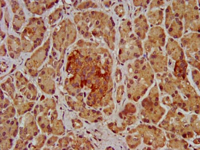 SHROOM2 Antibody