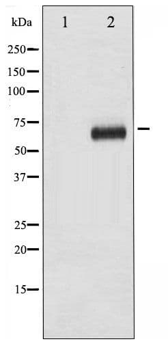RPS6KB1 / P70S6K / S6K Antibody (phospho-Thr421)
