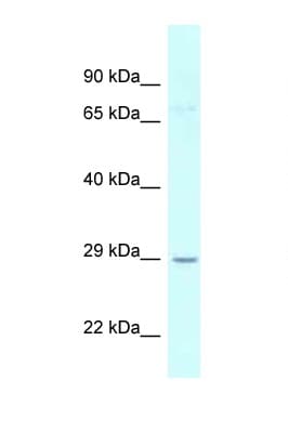 UCK1 Antibody (aa21-70)
