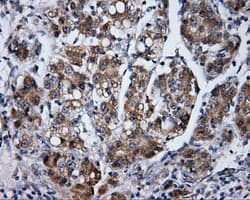 LIPG / Endothelial Lipase Antibody (clone OTI9C5)
