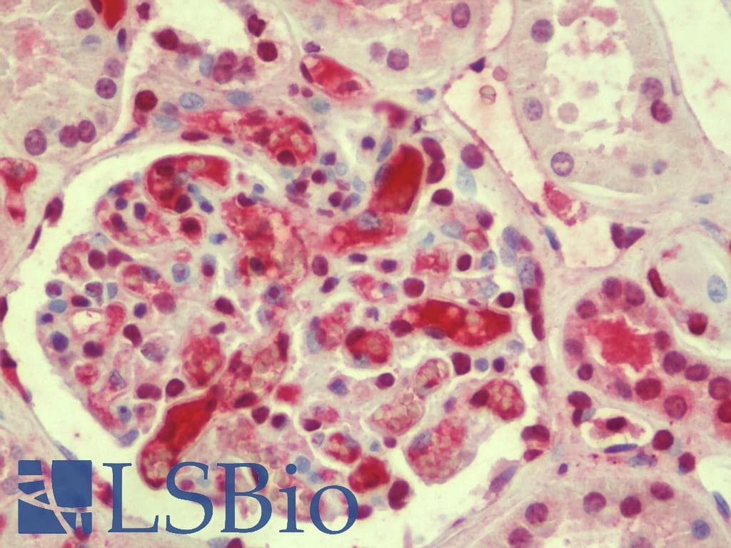 IHC-plus™ AFAP1L1 Antibody