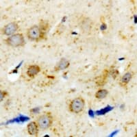 Polyclonal Rabbit anti-Human ADRA1A Antibody (C-Terminus, IHC, IF, WB)