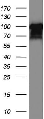 MCAM / CD146 Antibody (clone UMAB154)