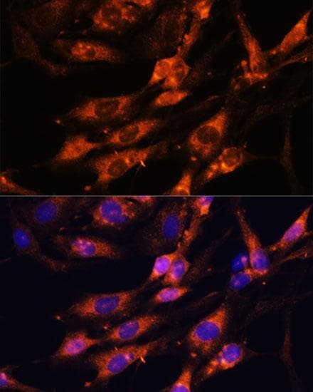 Polyclonal Rabbit anti-Human TNM / Teneurin-1 Antibody (IF, WB)