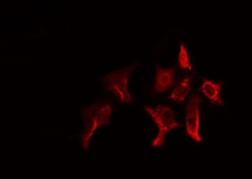 GSTT1 Antibody