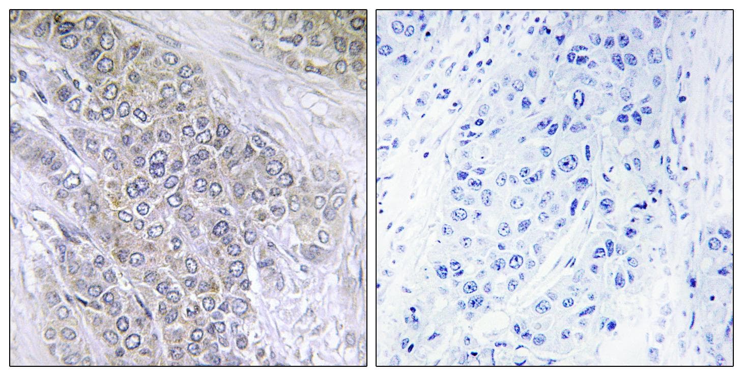 Polyclonal Rabbit anti-Human BCL2 / Bcl-2 Antibody (phospho-Thr56, IHC, IF, WB)