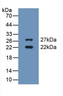 CIRP / CIRBP Antibody (aa1-172, PE)