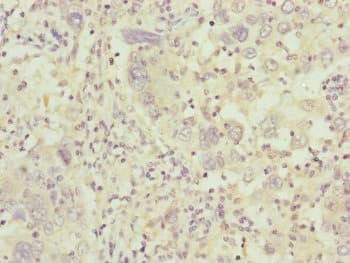 Complement C8b Antibody (aa55-350)