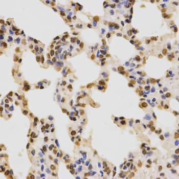 Histone H3 Antibody (Di-Methyl-Lys36)