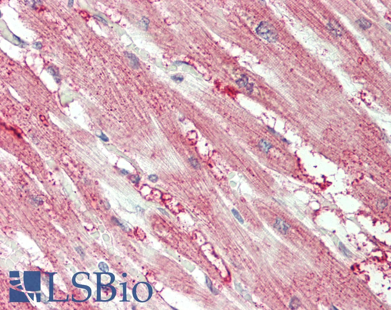 IHC-plus™ HUNK / B19 Antibody (aa238-287)