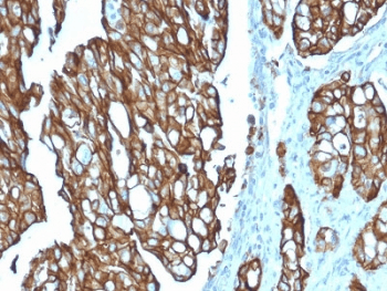 TROP2 / TACSTD2 Antibody (clone TACSTD2/2151)