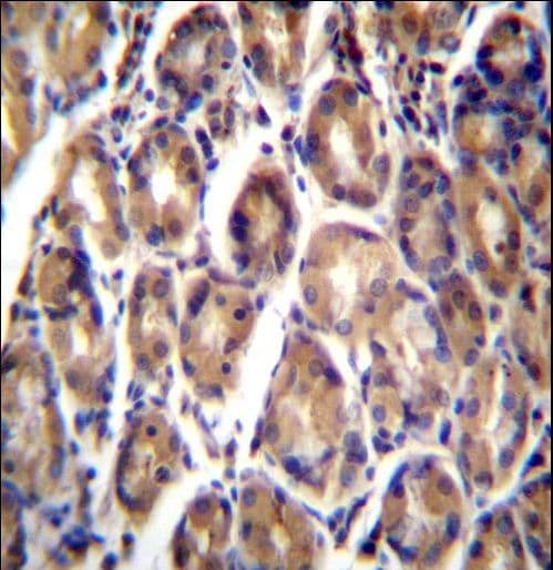 RARRES1 Antibody (aa134-163)