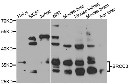 BRCC3 / BRCC36 Antibody
