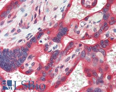 IHC-plus™ Polyclonal Rabbit anti-Human ADGRG6 / GPR126 Antibody (IHC, WB)