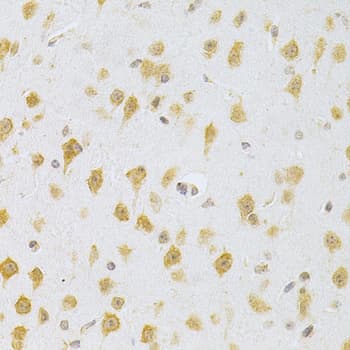 MDM2 Antibody