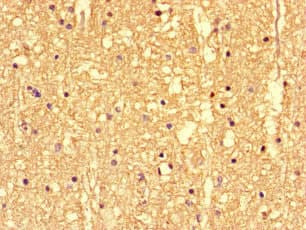 SS18L1 / CREST Antibody