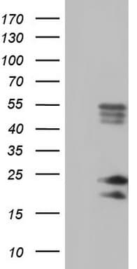 Polyclonal Rabbit anti-Human BAX Antibody (aa100-170, IHC, WB)