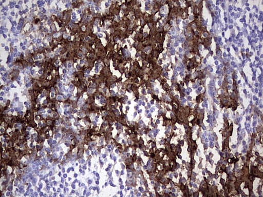 Monoclonal Mouse anti-Human S100A9 / MRP14 Antibody (clone OTI10D5, IHC, WB)