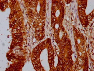 HIST1H4I Antibody
