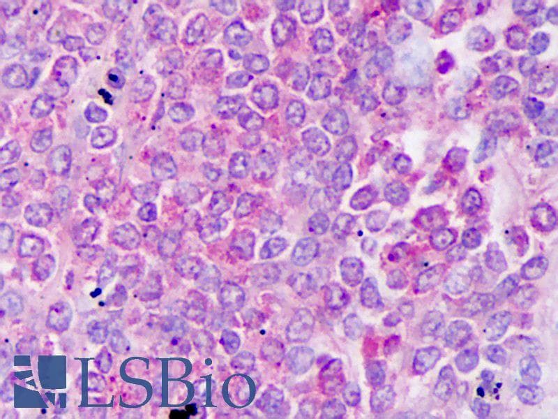 IHC-plus™ Monoclonal Mouse anti-Human CCL20 / MIP-3-Alpha Antibody (IHC, WB)