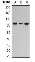 PRKCE / PKC-Epsilon Antibody (C-Terminus)