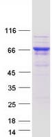Human PPP2R5D Protein (Recombinant Myc-DDK (Flag))
