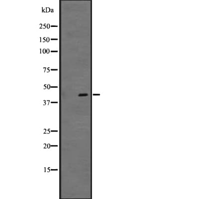 Polyclonal Rabbit anti-Human GPR34 Antibody (WB)