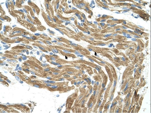 HAL / Histidine Ammonium Lyase Antibody (aa180-229)