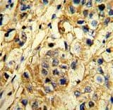 TIMP1 Antibody (aa41-70)