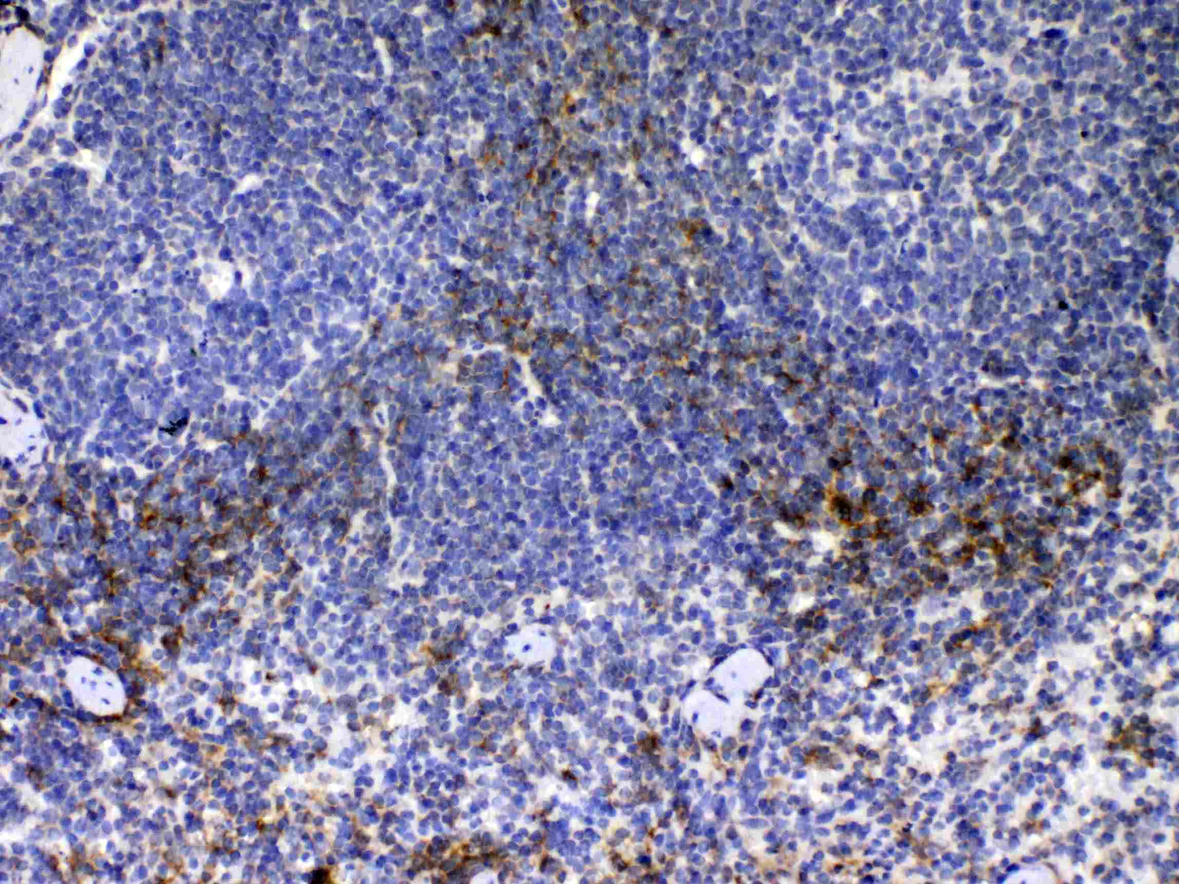 CD14 Antibody