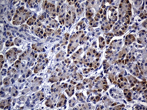 Monoclonal Mouse anti-Human FHIT Antibody (clone OTI1D7, Carrier-free, IHC, WB)