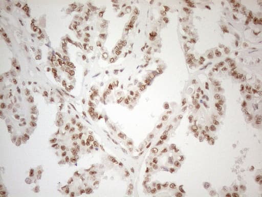 Monoclonal Mouse anti-Human WTAP Antibody (clone OTI12G7, aa2-106, IHC, WB)