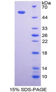 Human FCAR / CD89 Protein (Recombinant His-GST)