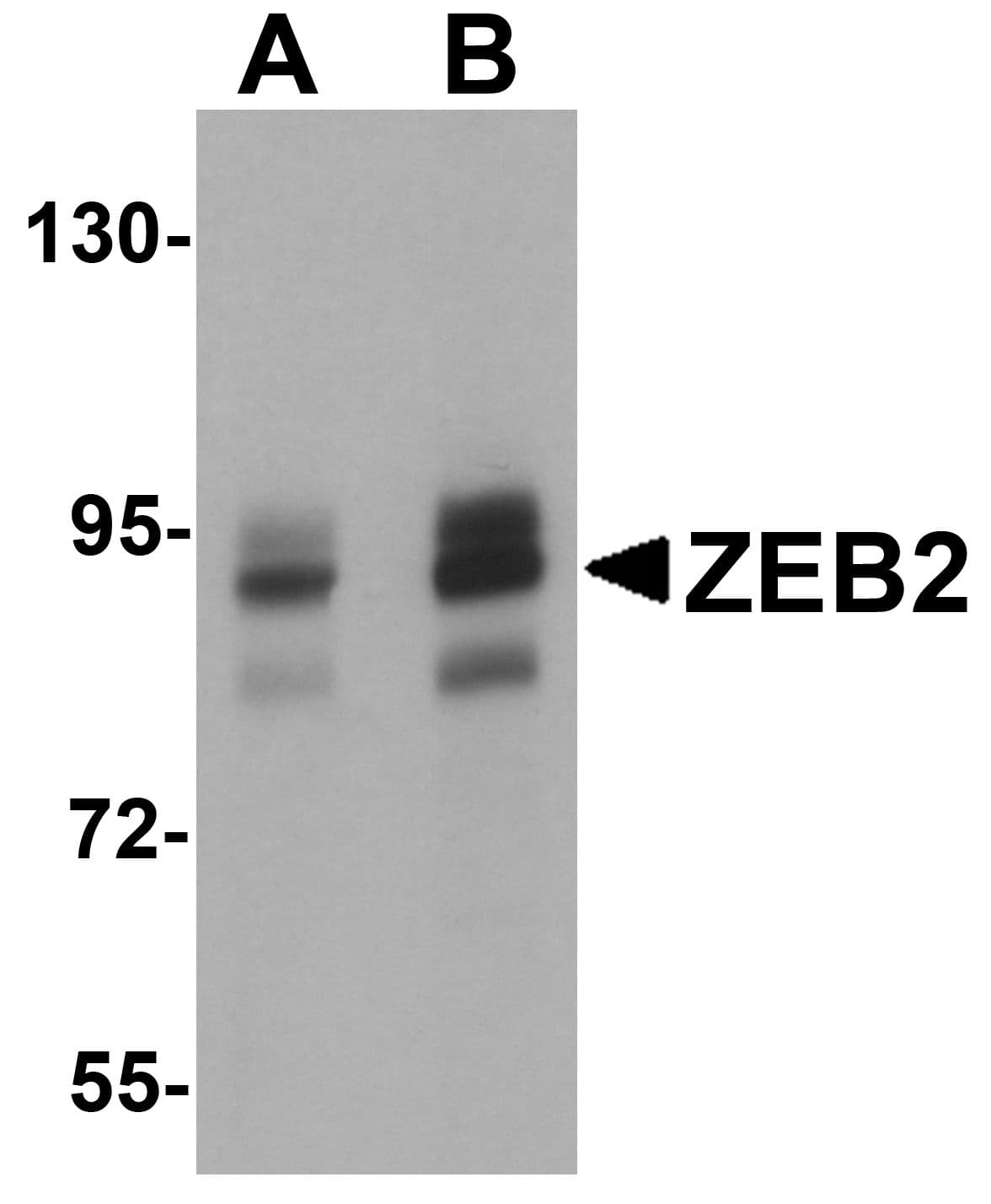 IHC-plus™ ZEB2 / SIP-1 Antibody