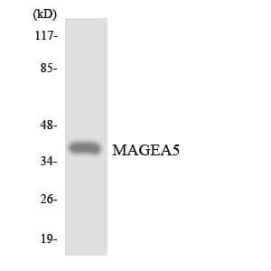 MAGEA5 Antibody (aa58-107)