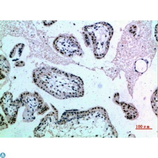 Polyclonal Rabbit anti-Human NOL5A / NOP56 Antibody (WB)