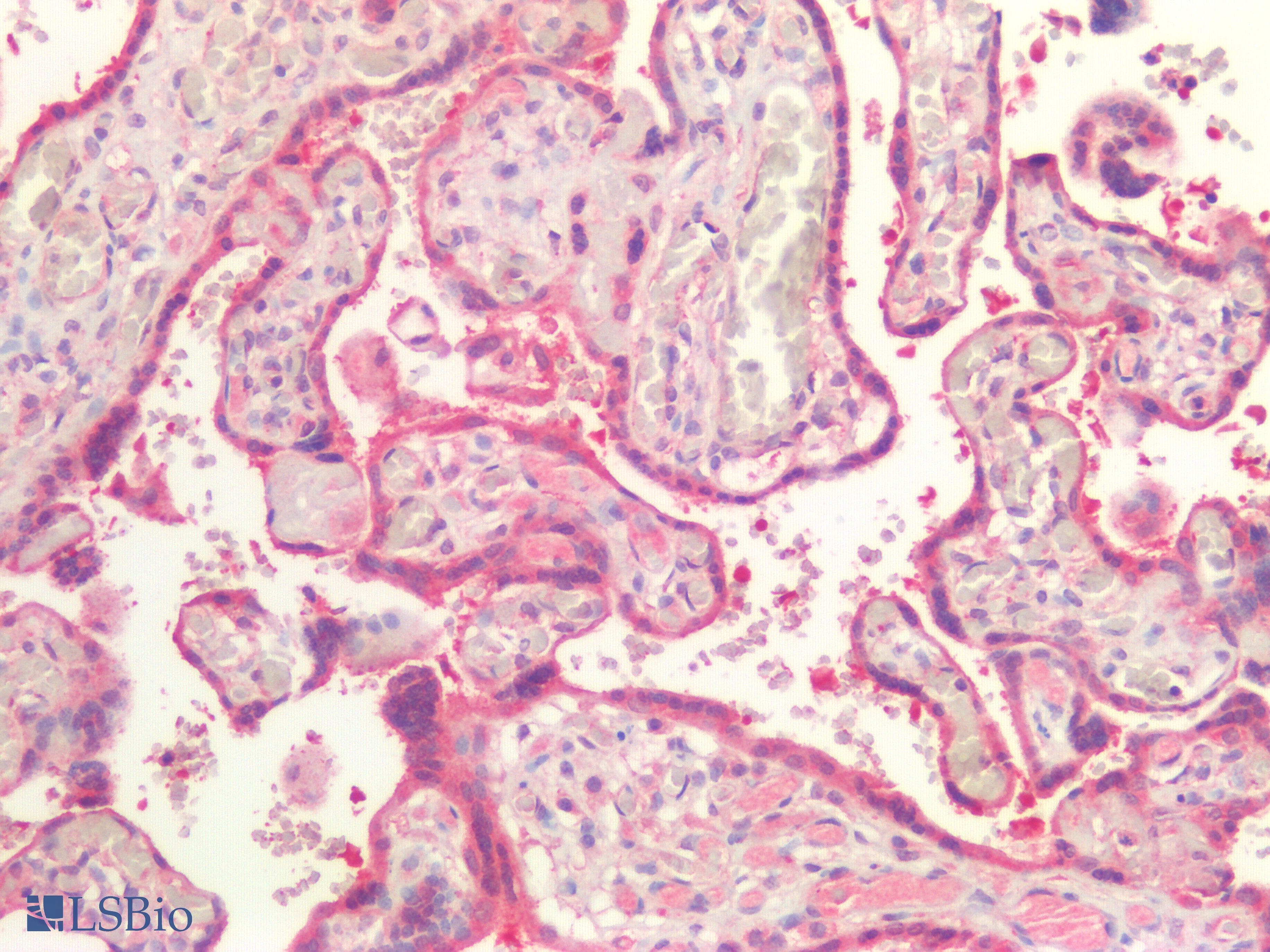 IHC-plus™ ABCB4 / MDR3 Antibody (Concentrated)